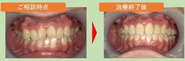 院長